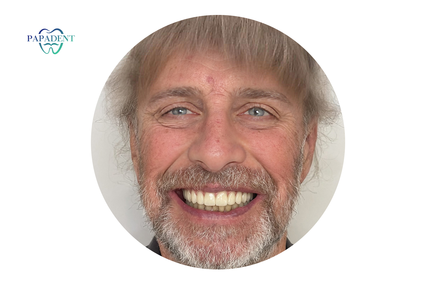 Dainius' Erfolgsgeschichte mit All on 4